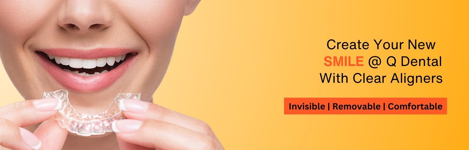 Q DENTAL HOSPITALS Best Dental Clinic for Dental Implant with Top